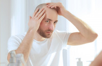 ​El auge de los tratamientos ‘milagro’ para la caída del cabello