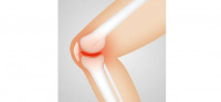 La teleasistencia, un recurso para optimizar el manejo clínico de la artrosis de rodilla
