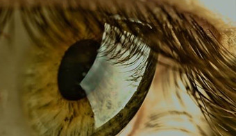 3cornea