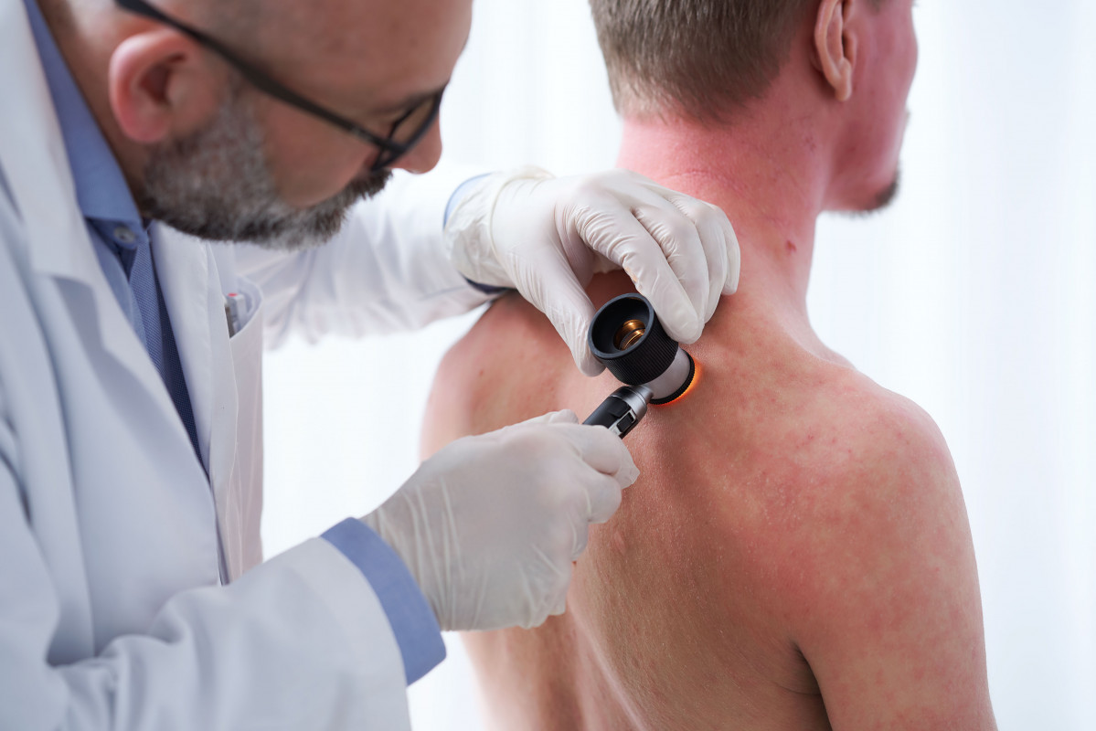 AtopicDermatitis Torben ClinicalSetting Back Examination 1