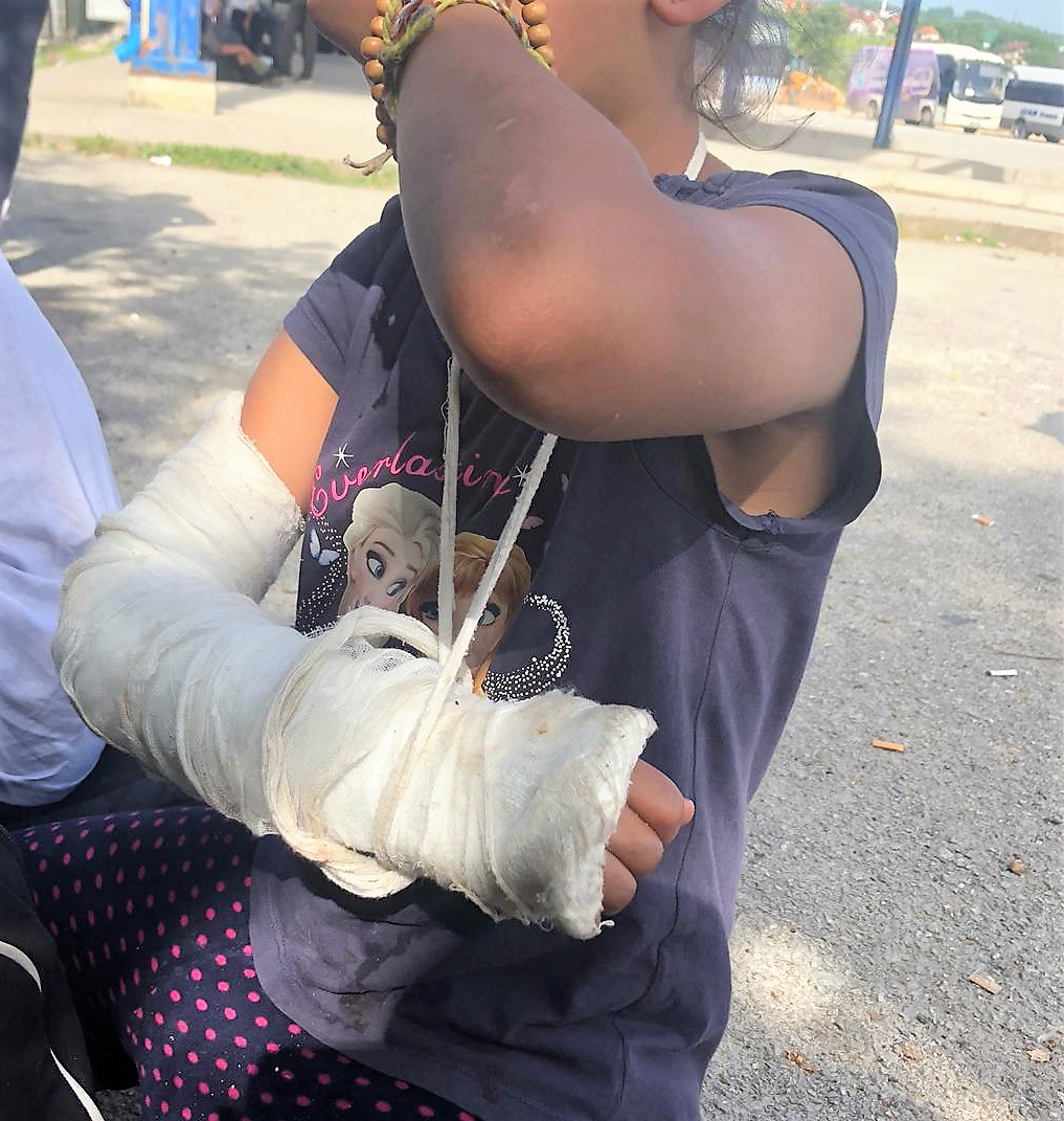 Niña de Iraq con el brazo roto. Su familia contó que la niña cayó de los brazos de su padre cuando la policía lo golpeaba durante una devolución