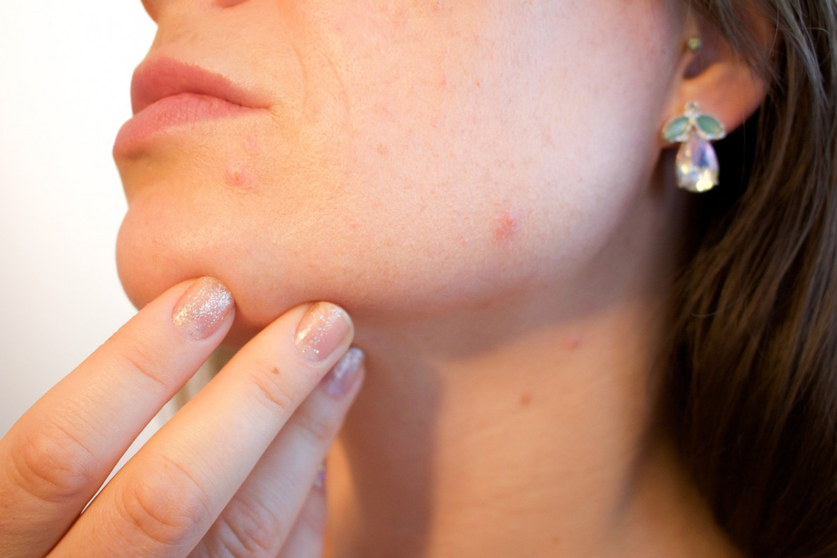 Acne 1606765 1280