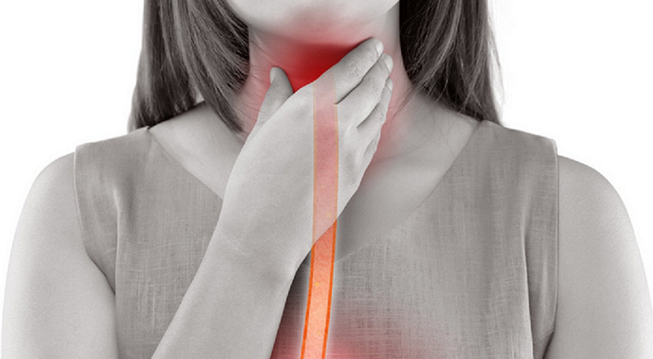 Achalasia 5265848 1280