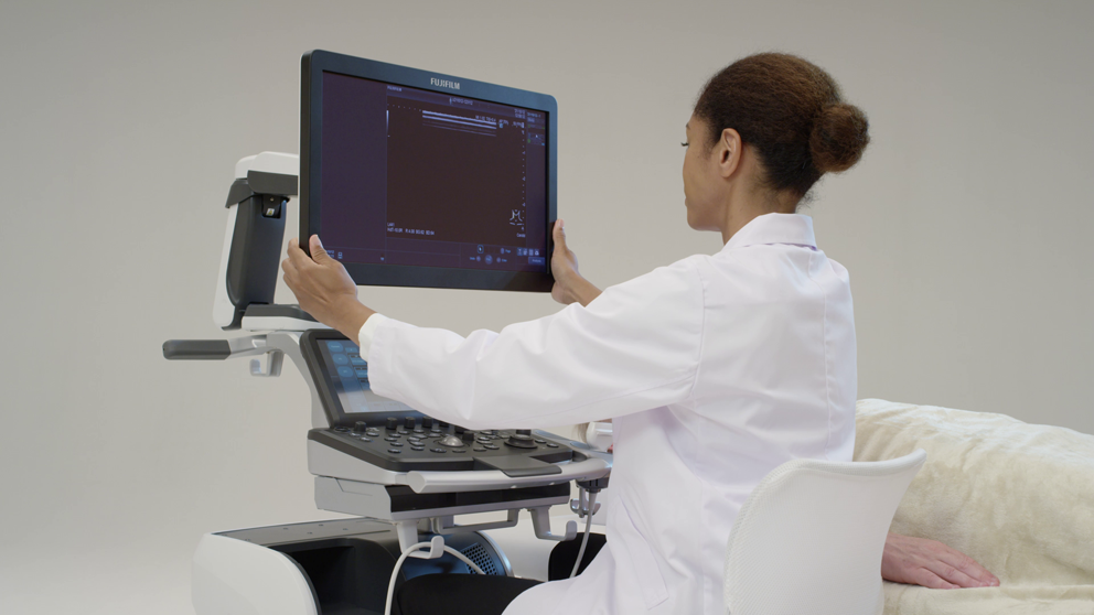 ARIETTA 650 DeepInsight Ultrasound System Product Images