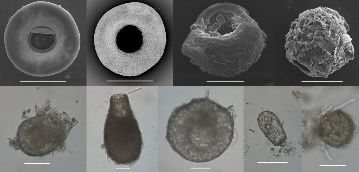 Especies de Arcellinida de lagunas saladas