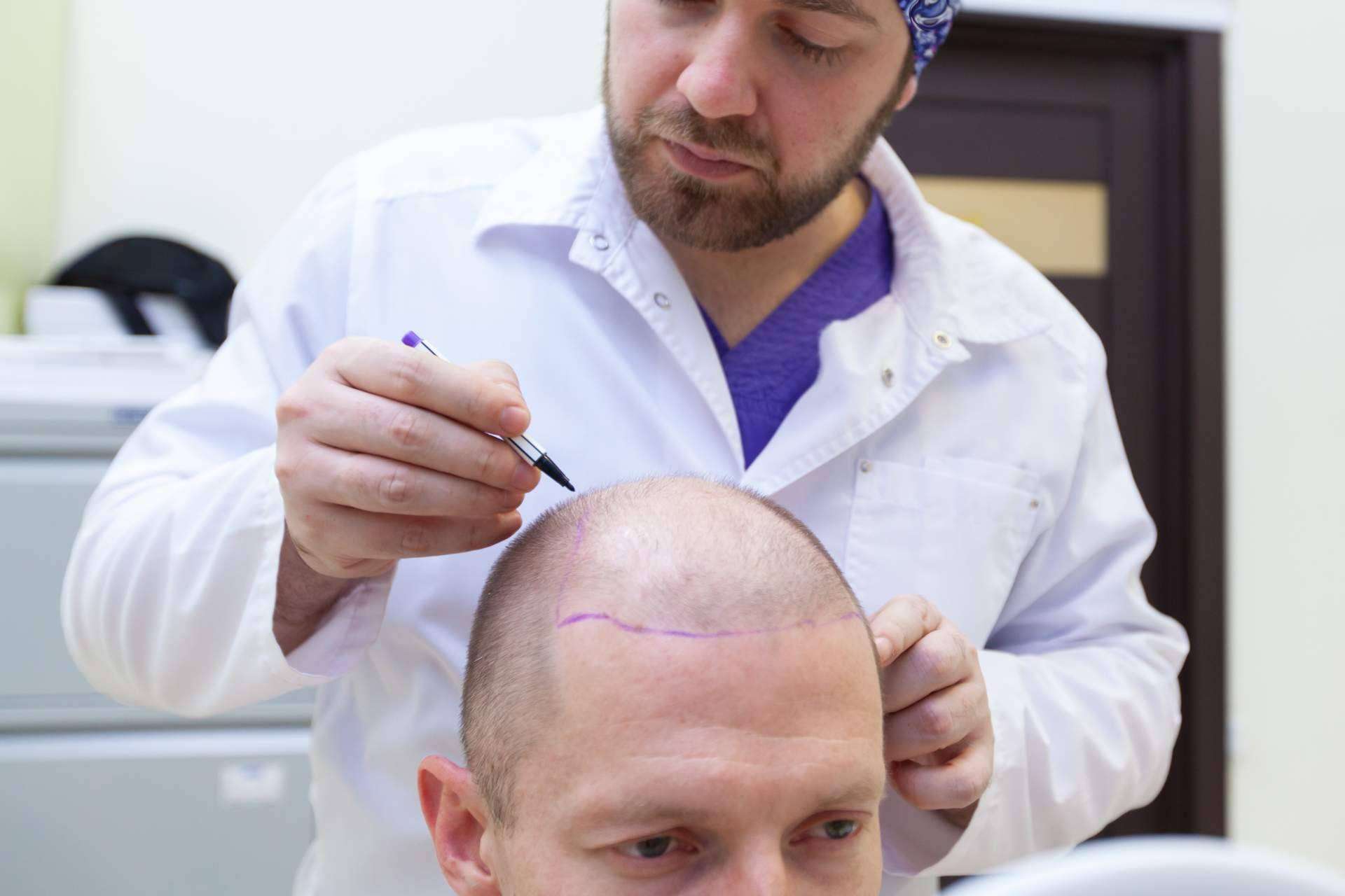Caída de pelo hormonal o carencial: el tratamiento efectivo de Géomer