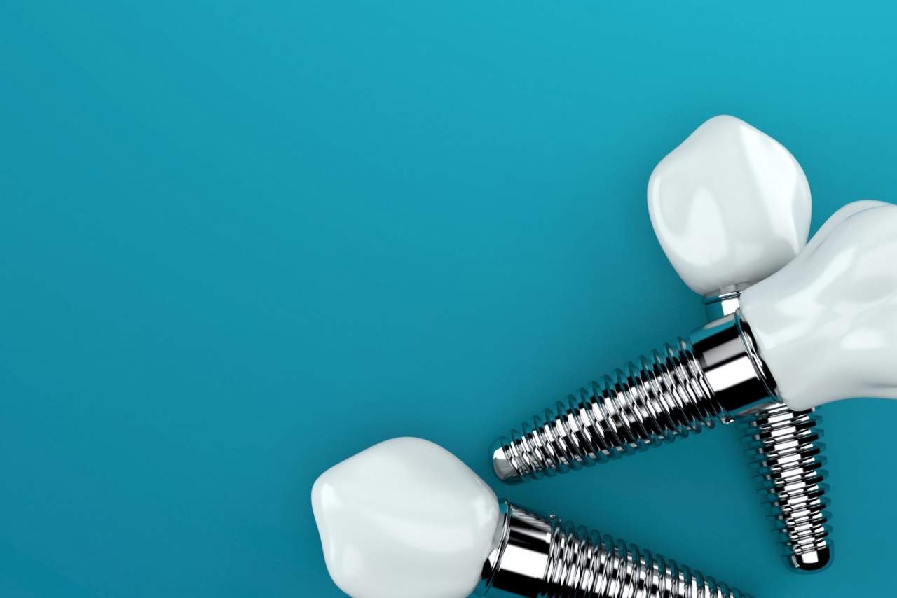 Helident: Implante dental profesional en Sevilla