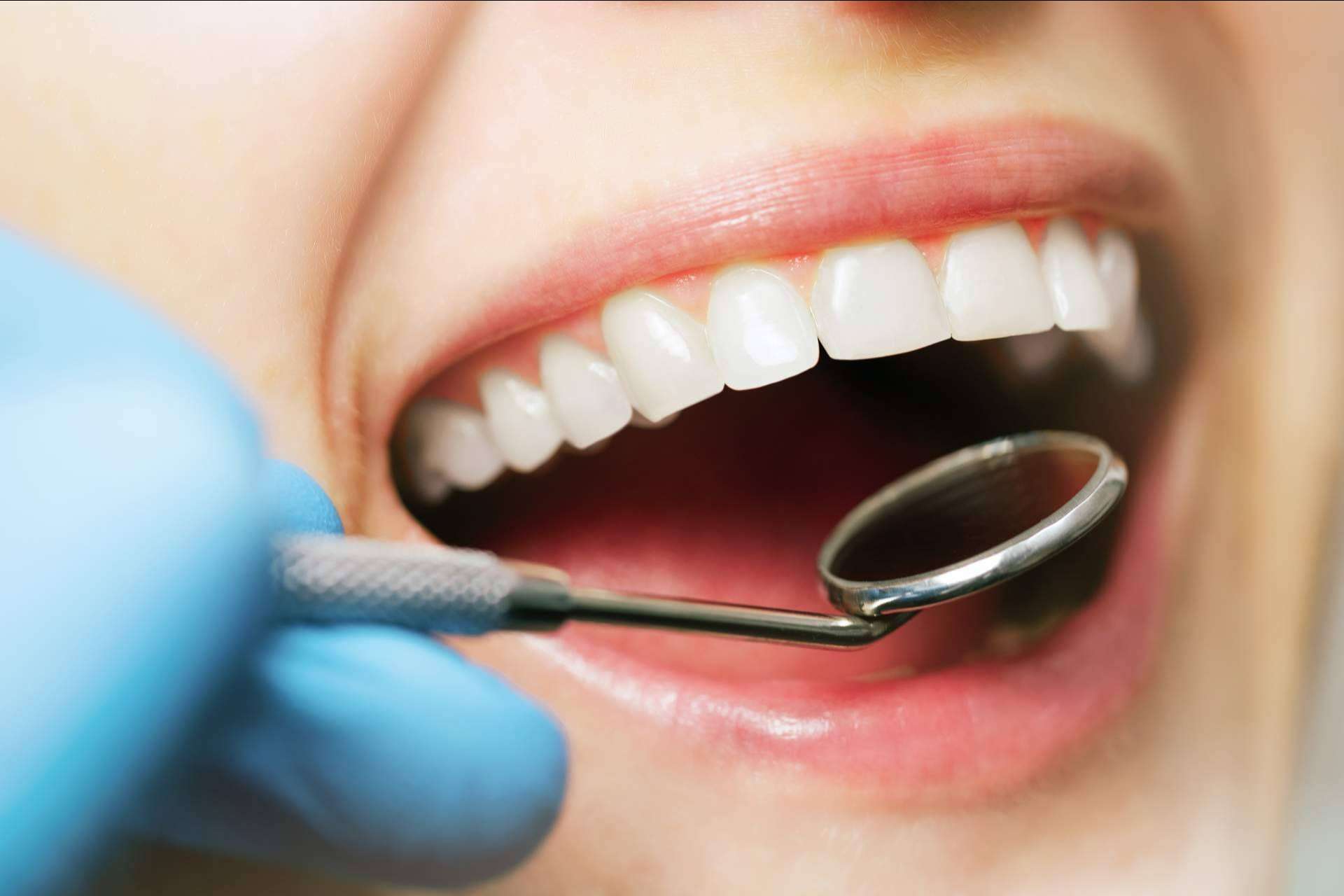 Tecnología y profesionalidad en odontología estética en Sevilla de la mano de Clínicas Dental Bell