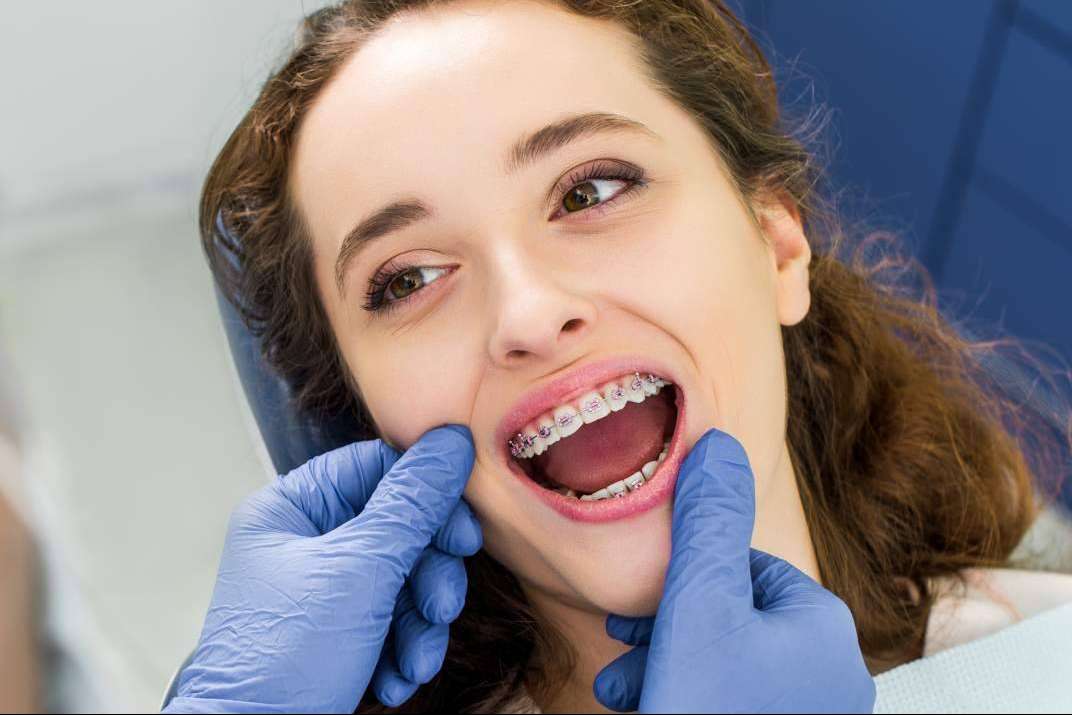 Beneficios de la ortodoncia estética, con Agudo Rosa