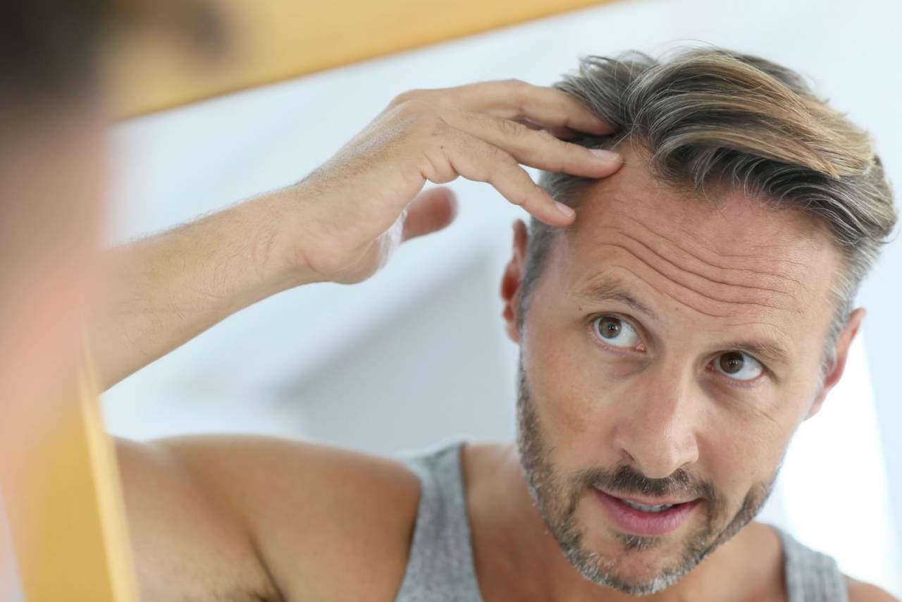 ¿Son las prótesis capilares a medida el futuro?: Soluciones de My Special Hair