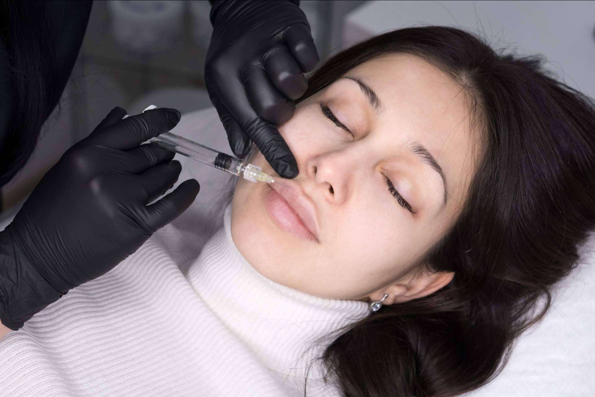 Aumento de labios en Barcelona de la mano del Dr. Carlos Zito