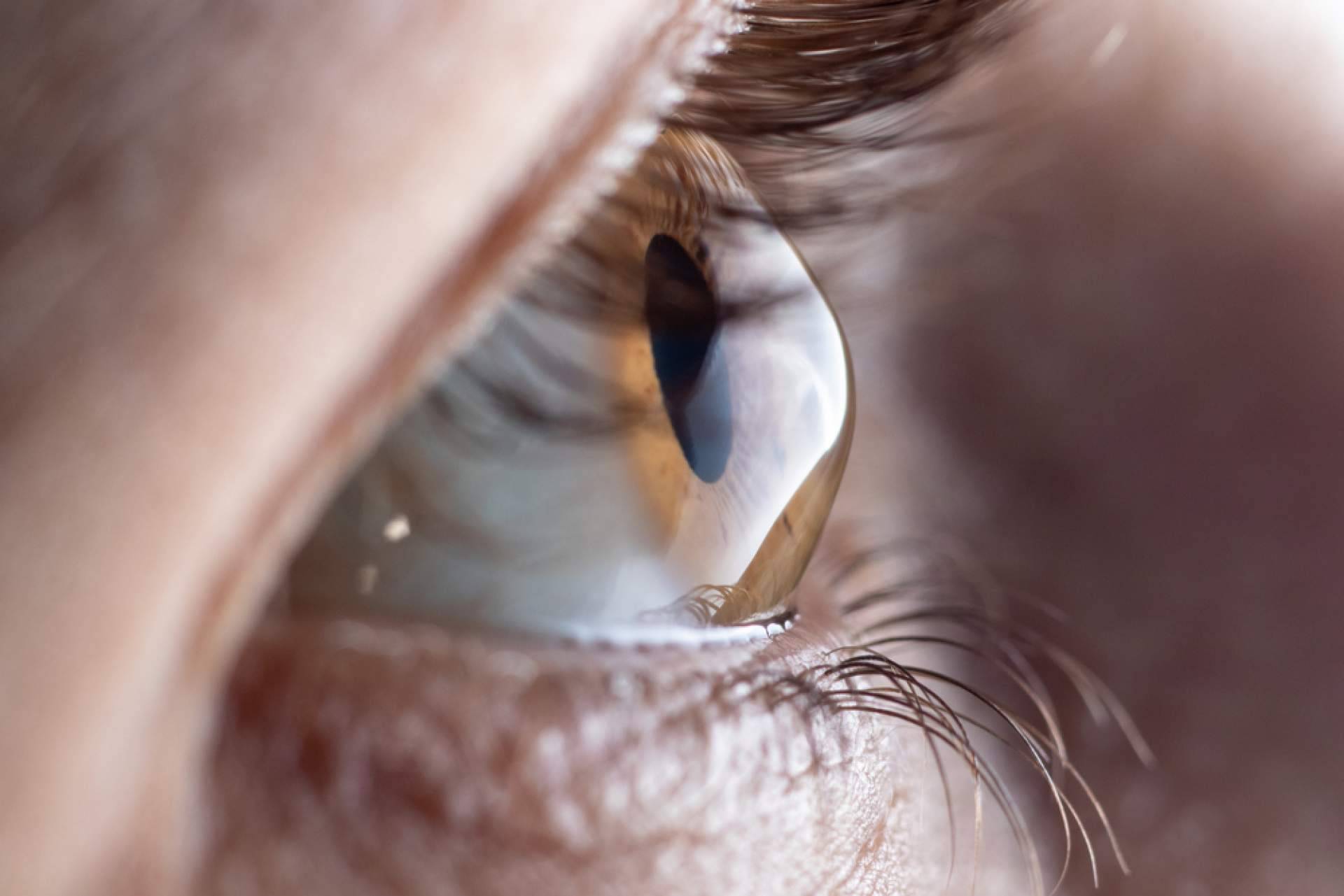 Departamento de Oftalmología del Instituto Universitario Dexeus elimina de forma definitiva el uso de gafas o lentillas