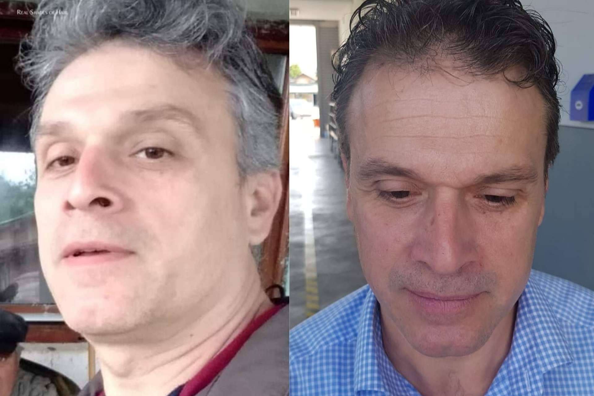 GR-7 Professional: la sinergia de 4 componentes naturales para acabar con las canas