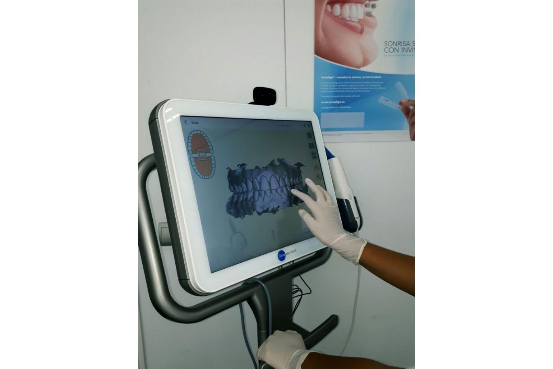 Clínica de Ortodoncia Mariana Sacoto Navia: la única clínica en Barcelona especializada exclusivamente en ortodoncia invisible Invisalign®