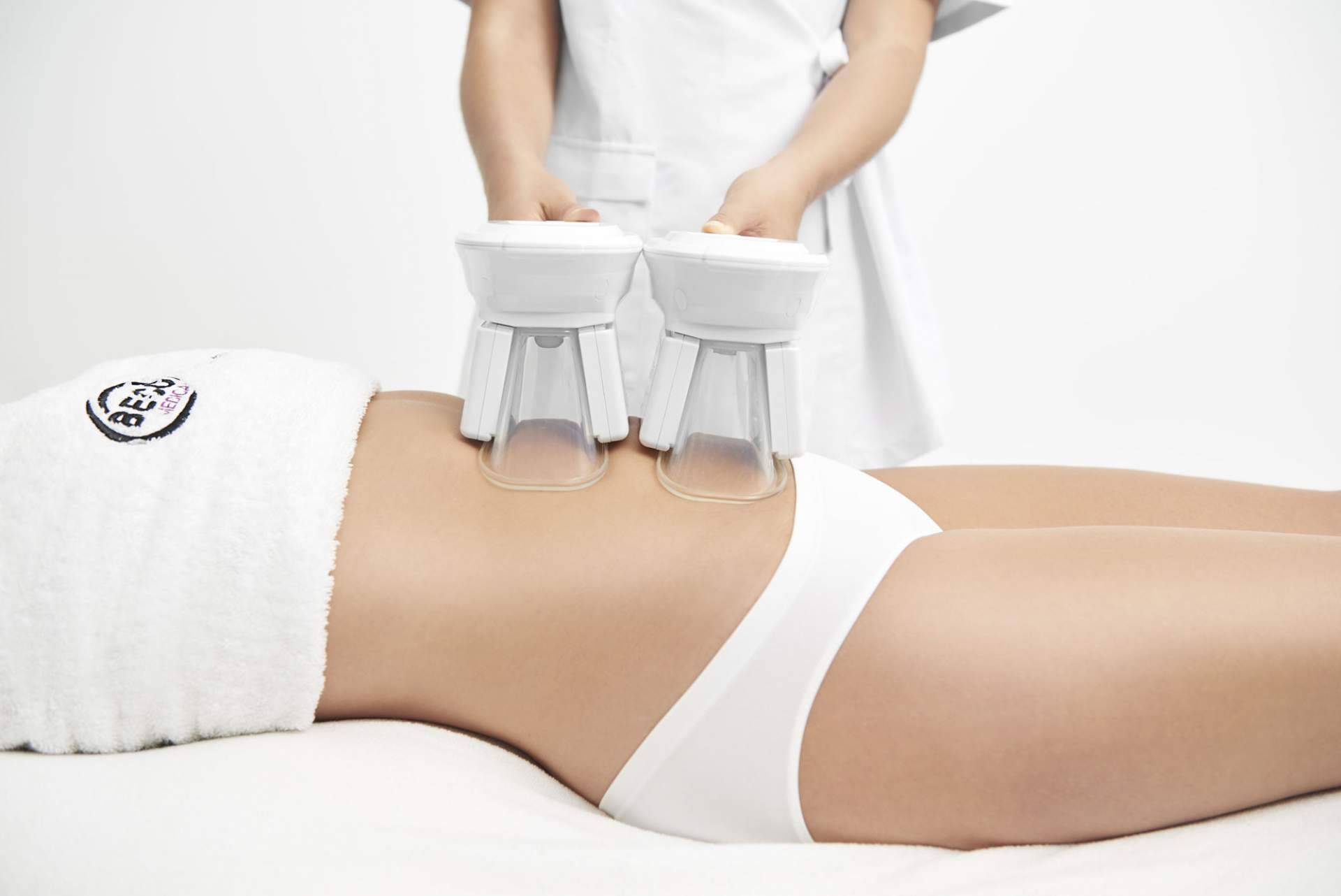 Criolipolisis en Milladoiro de la mano del centro MF estética