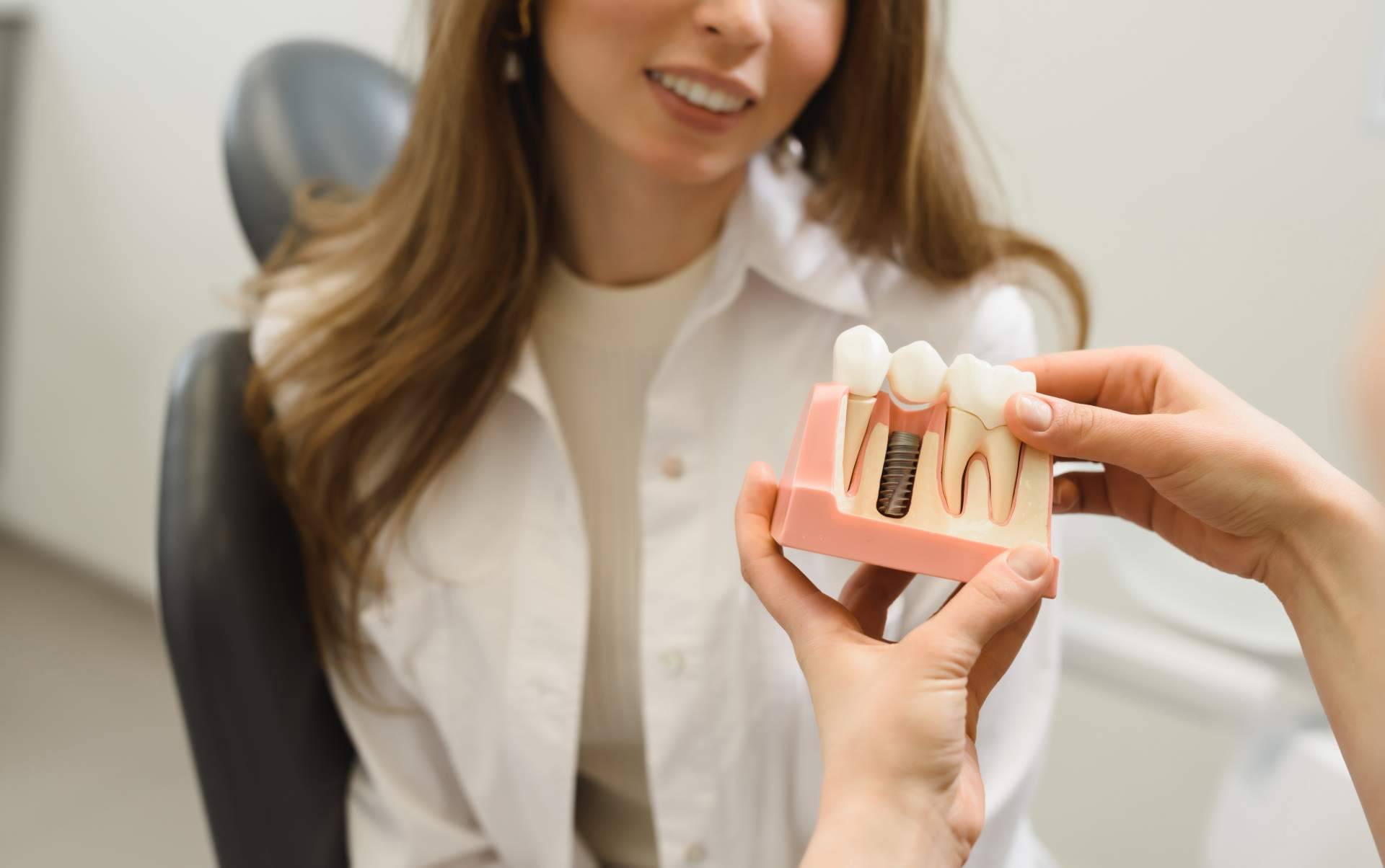 Los tipos de implantes dentales, por Bucalia