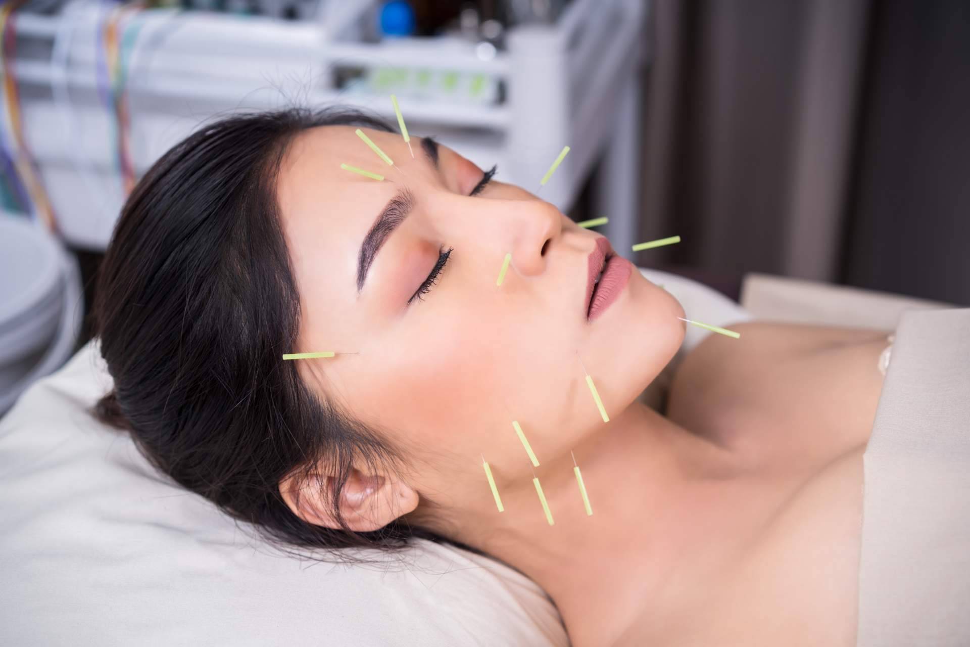 Acupuntura estética a domicilio por el centro Kikai