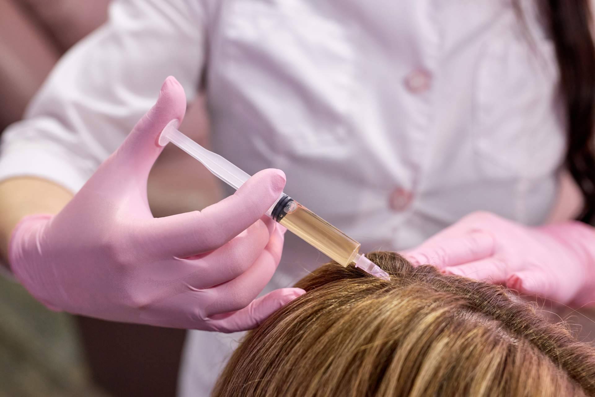 Mesoterapia capilar en Benidorm y Elche de la mano de Élite Capilar