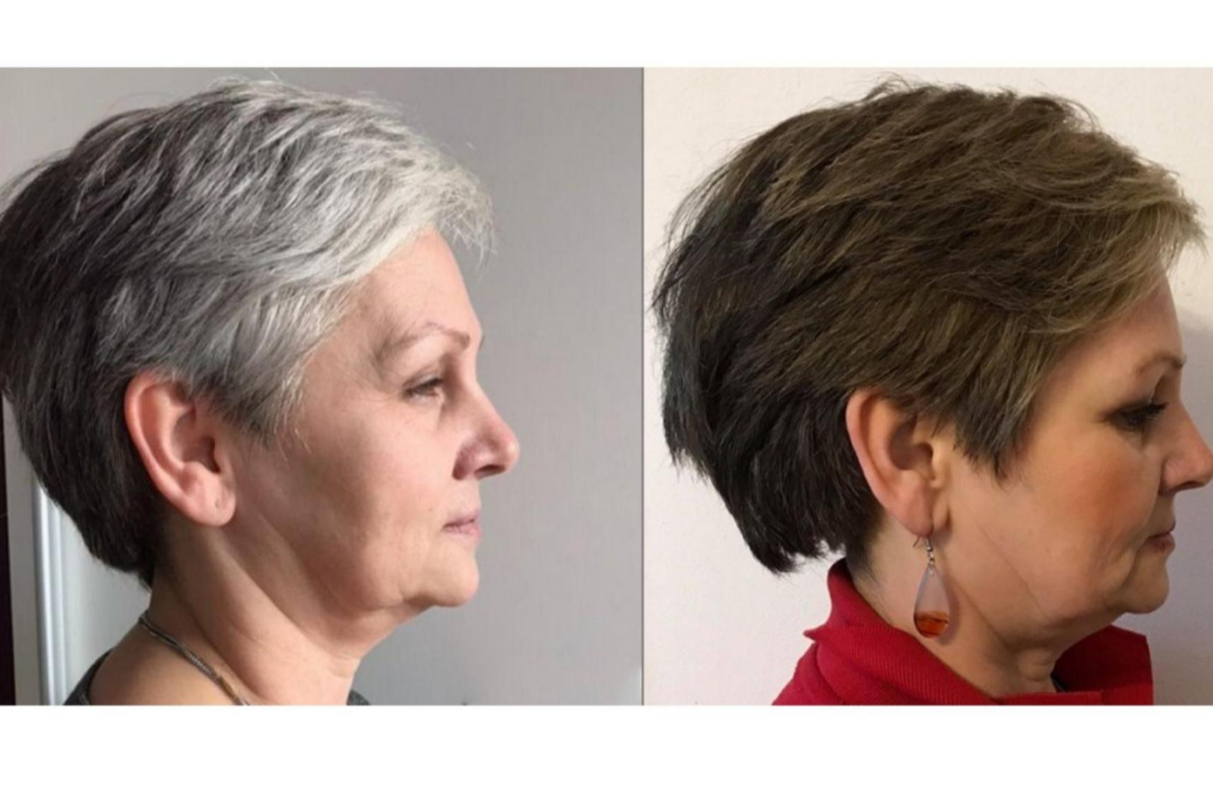 ¿Cómo tapar las canas sin tinte gracias a la loción GR-7 Professional?