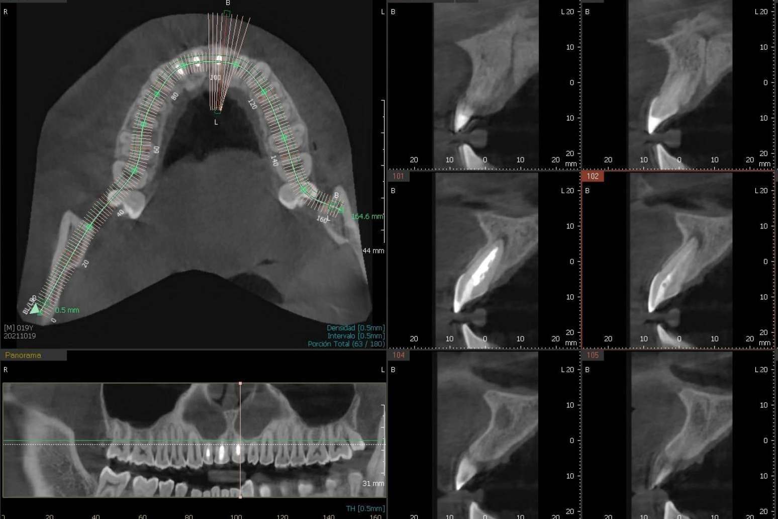 El innovador CBCT dental 3D que realiza la Clínica Blay+Monzó