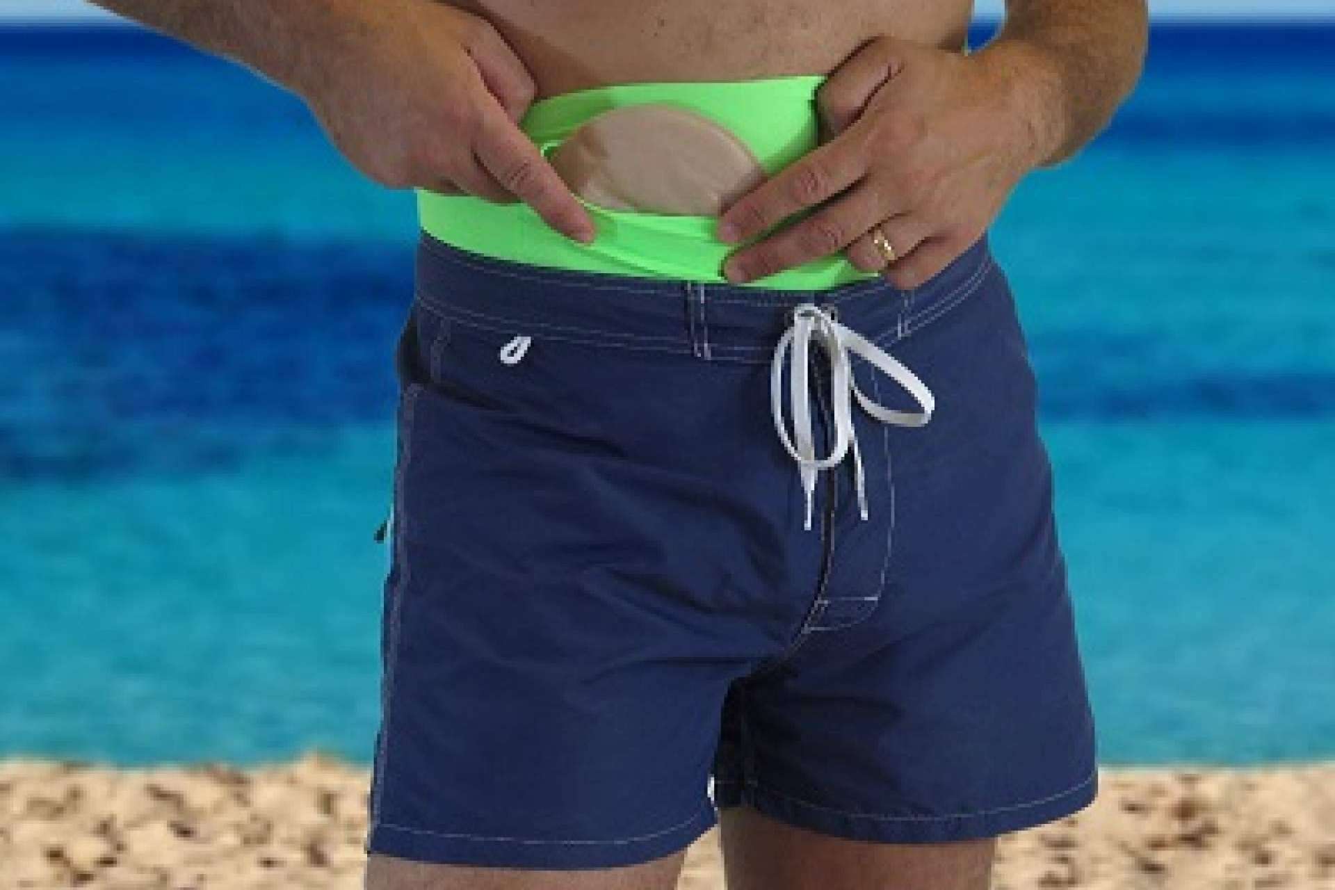 Las fajas para bañarse en la piscina con una ostomía que ofrece Maldita Hernia