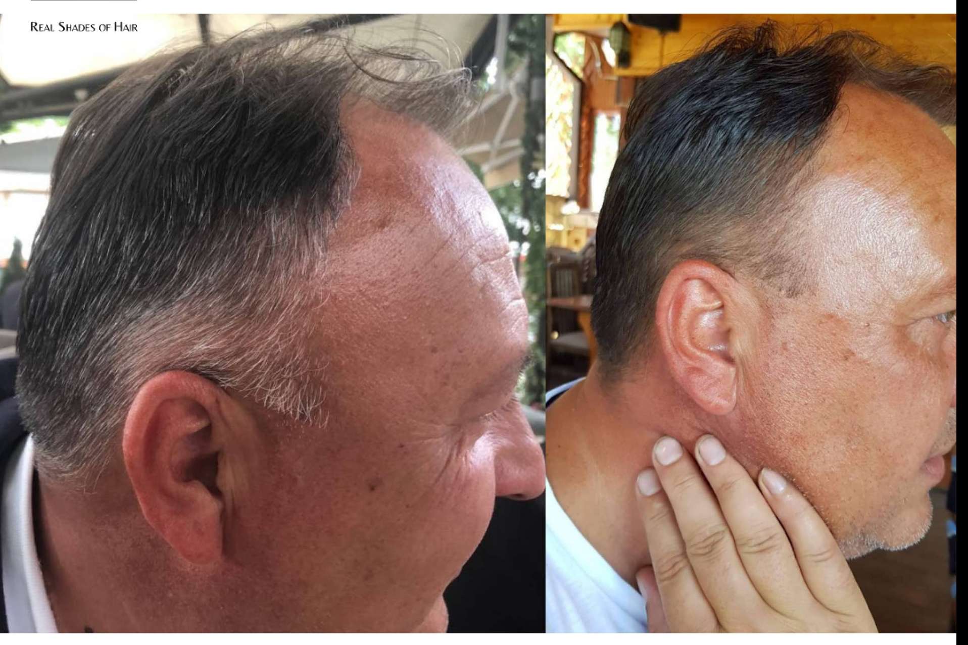 Jóvenes con canas, ¿Cuáles son los factores que influyen en su aparición?