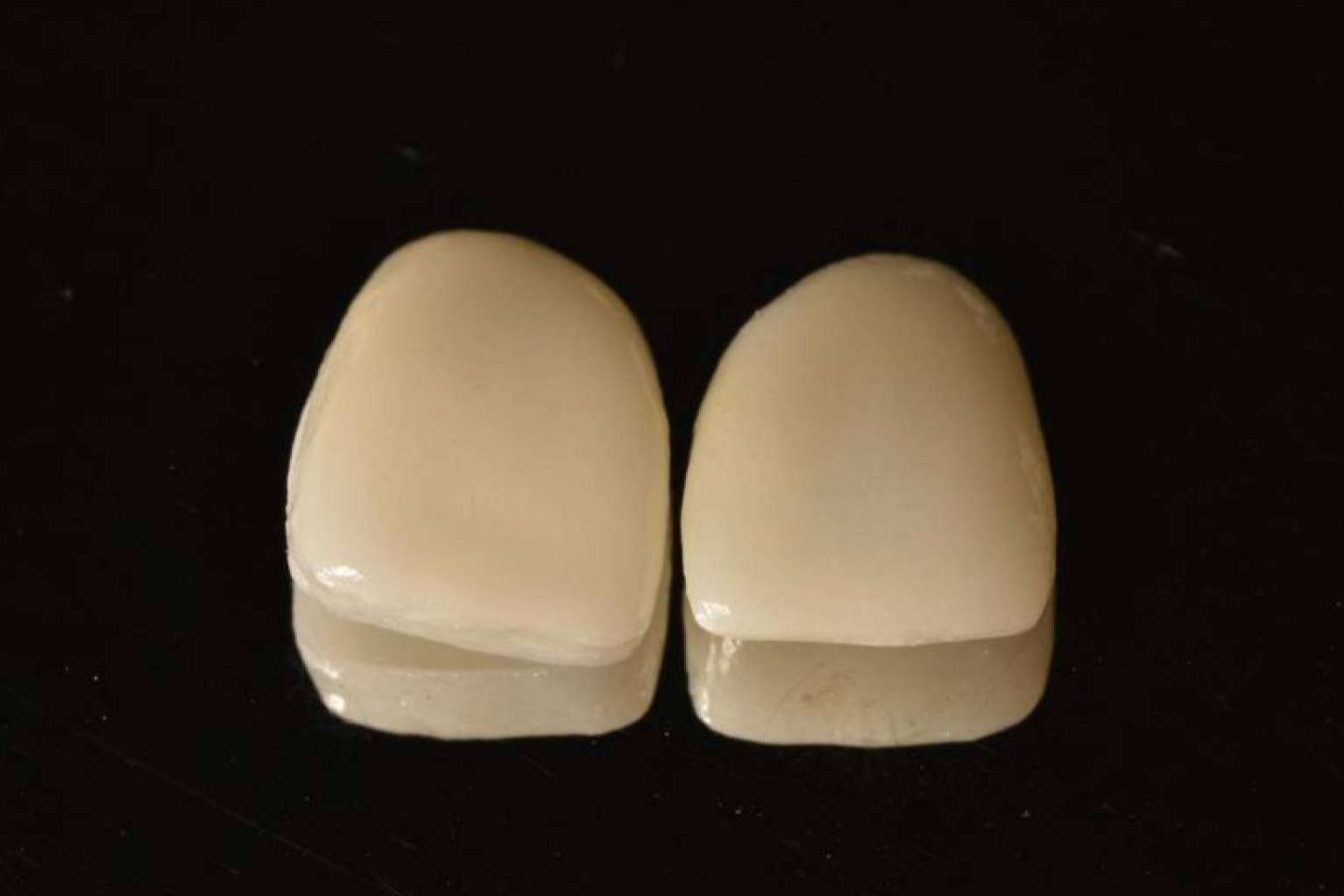 Implant Clinics explica las ventajas de los tratamientos de estética dental