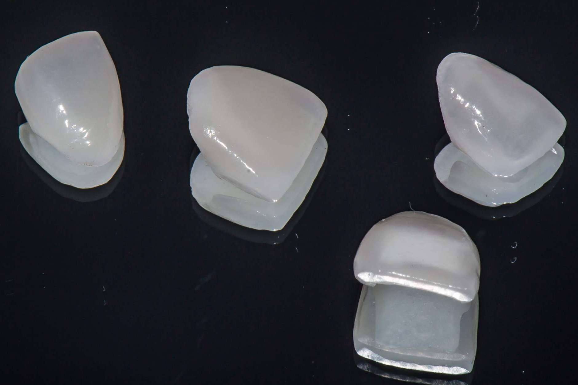 Carillas dentales de porcelana, uno de los mejores tratamientos para mejorar la estética dental