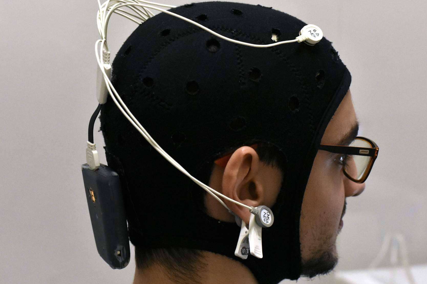 Los tratamientos de neuromodulación aceleran la recuperación tras sufrir un ictus