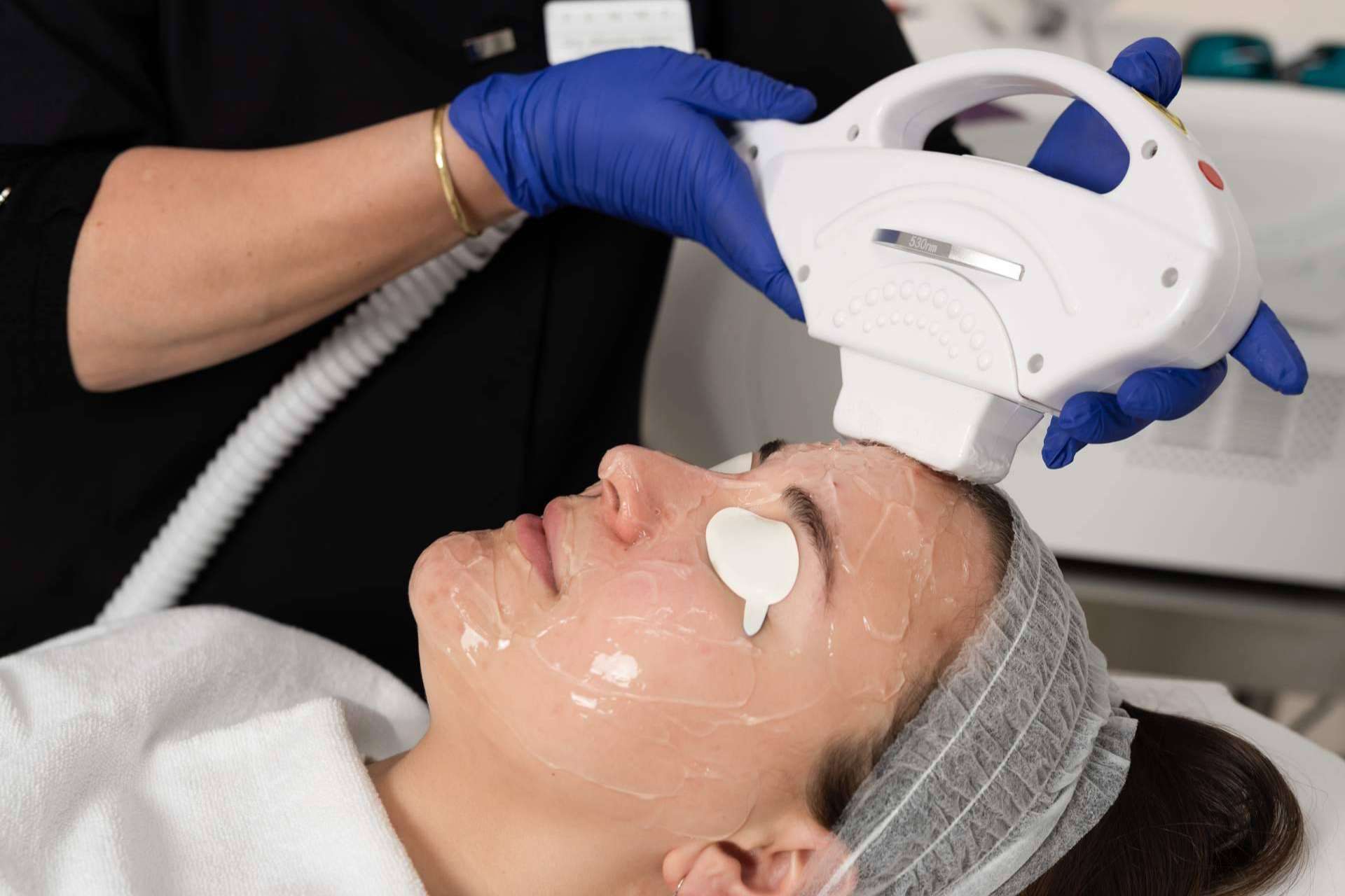Eliminar las manchas solares de la cara, cuello y escote con el tratamiento de luz pulsada