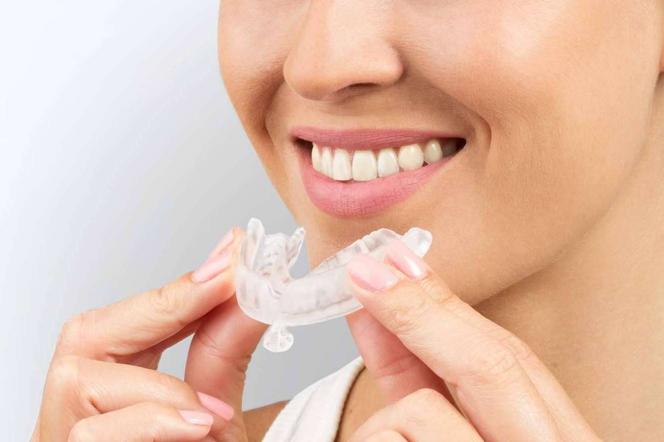 Férula dental Bruxistop para aliviar los efectos adversos del bruxismo