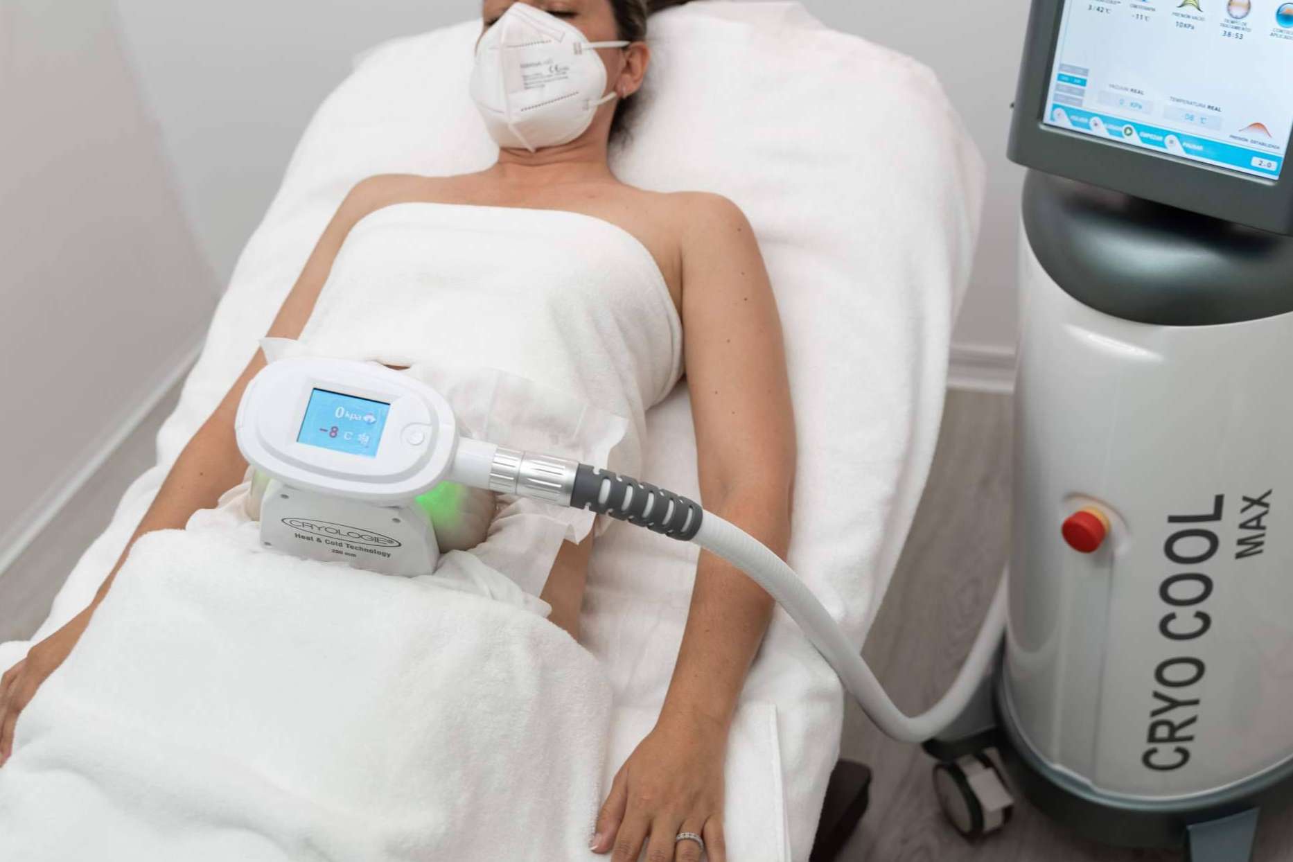 Tratamientos combinados de criolipólisis y estimulación electromagnética para reducir la grasa localizada