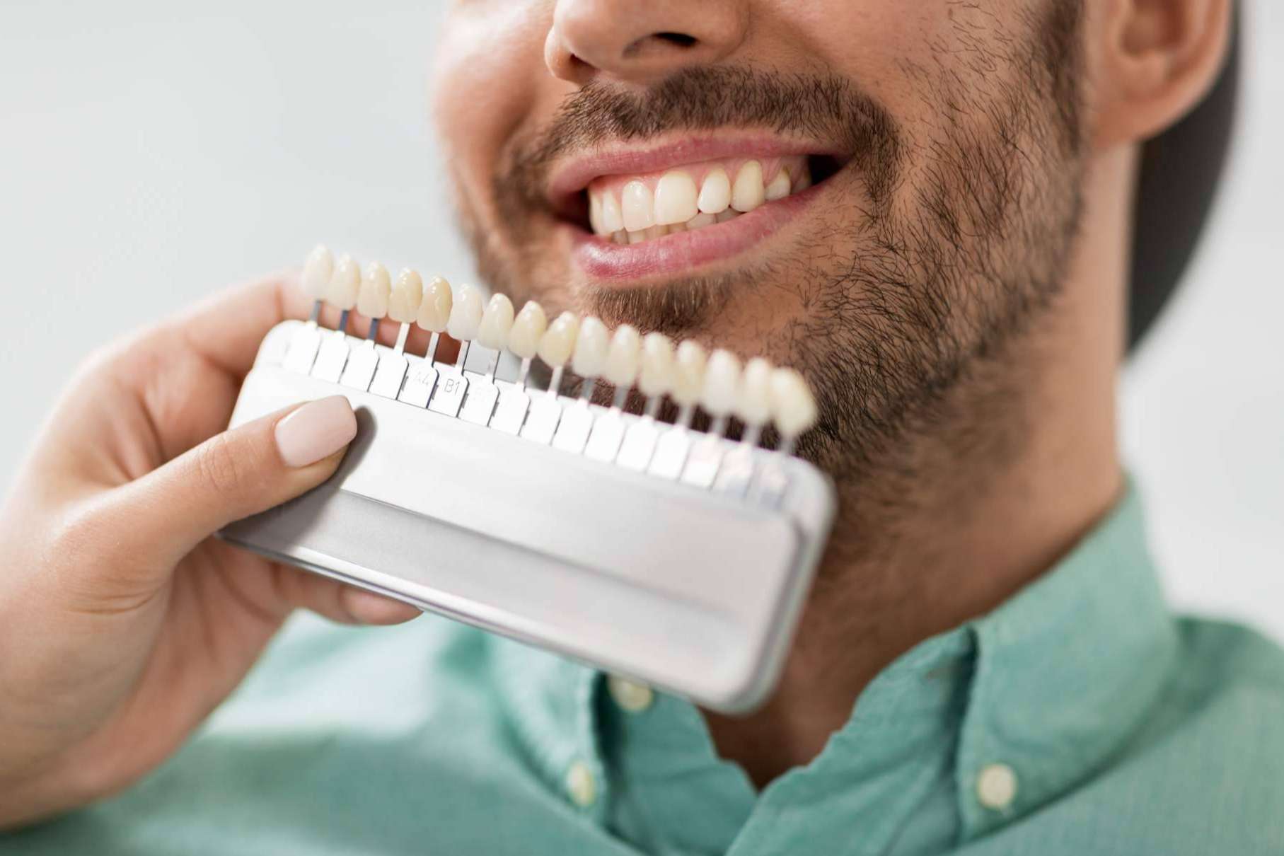 El blanqueamiento dental en casa complementa y mantiene los resultados del procedimiento clínico