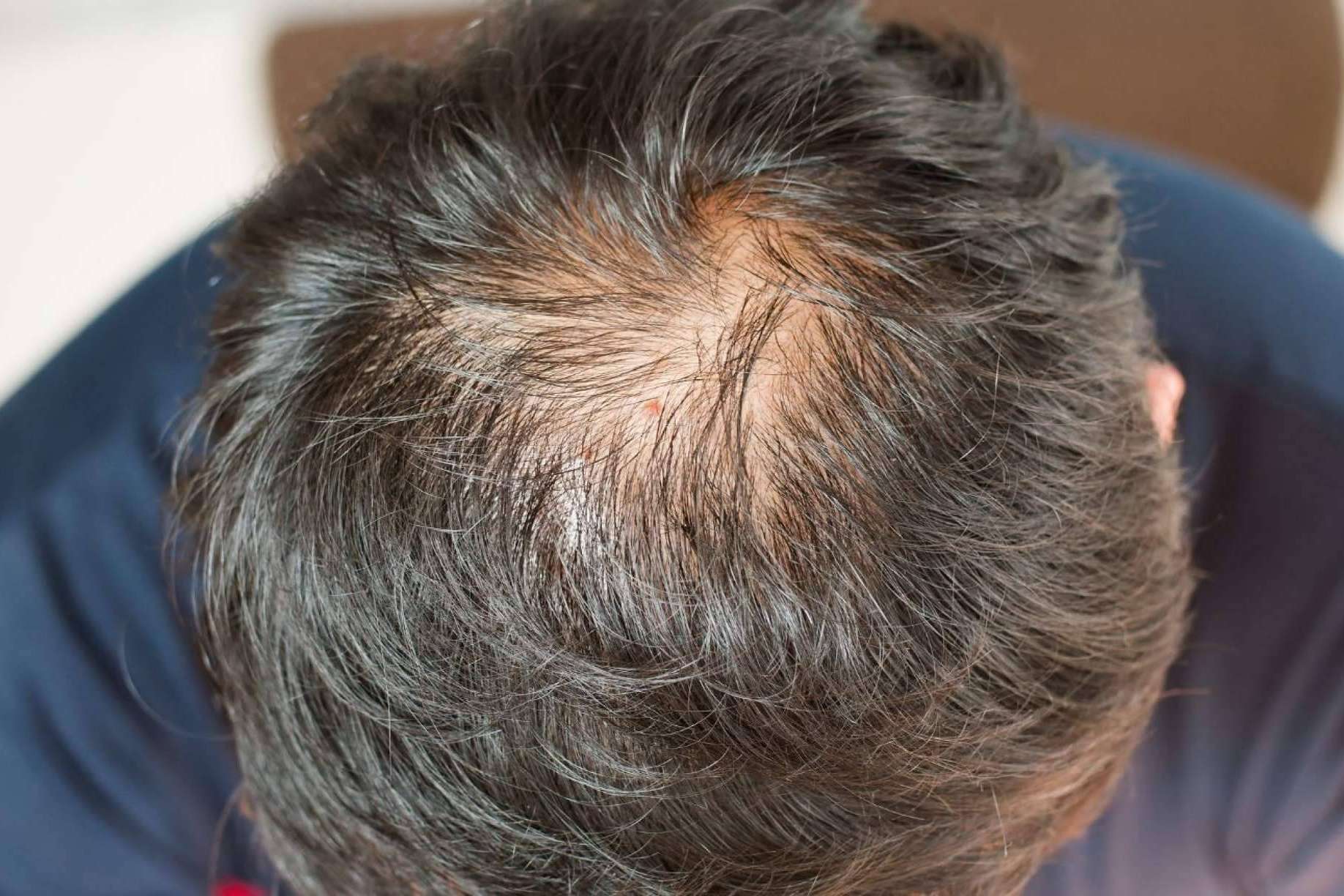 Los péptidos de cobre para combatir la caída del cabello, con Kmax