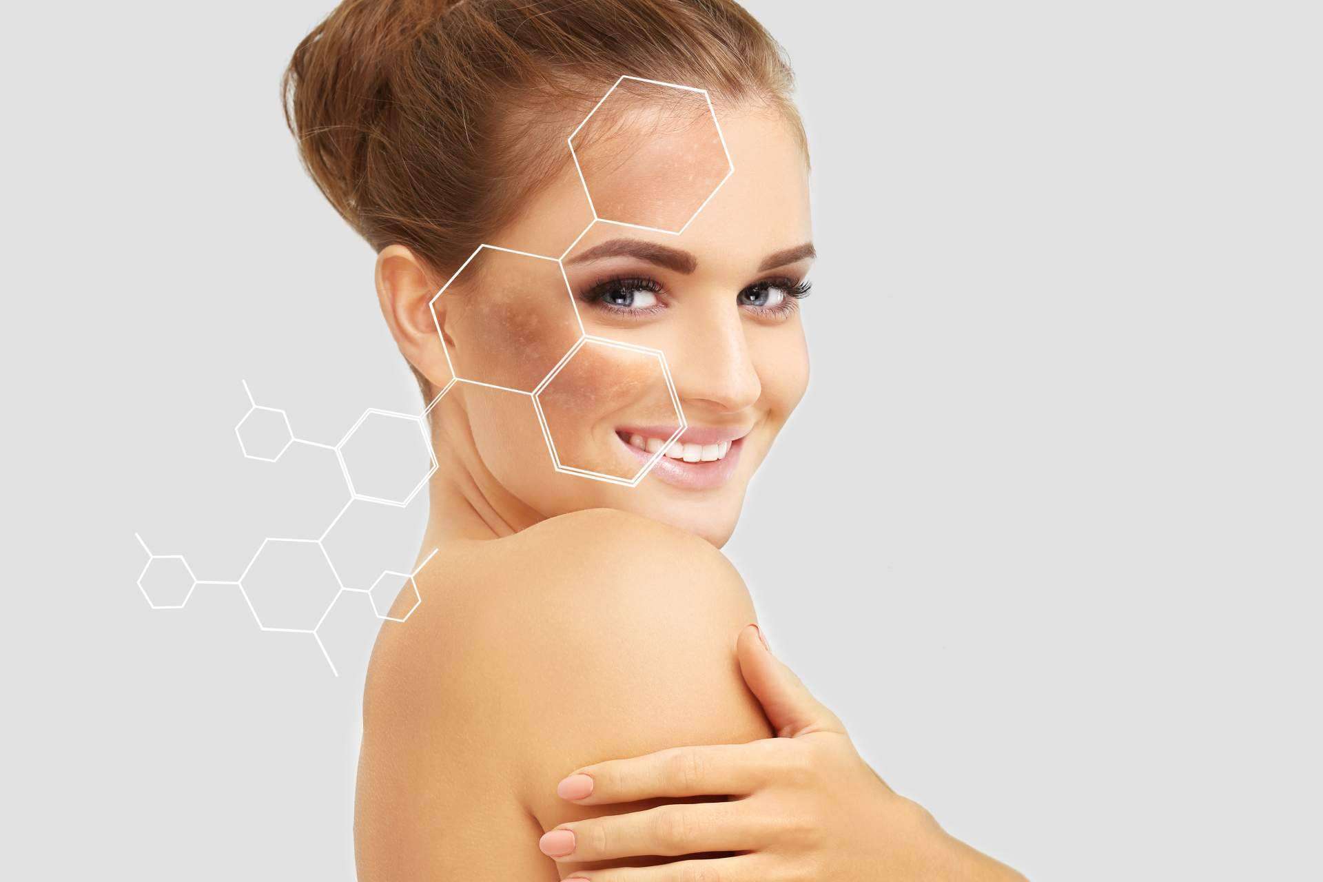 Tratamiento de peeling en verano con Clínica Femme