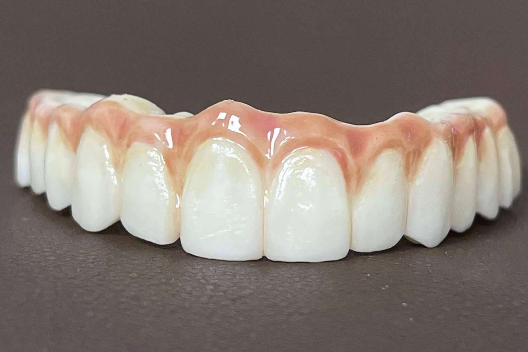 Dientes en un día es posible con la impresión 3D, por Dentinova