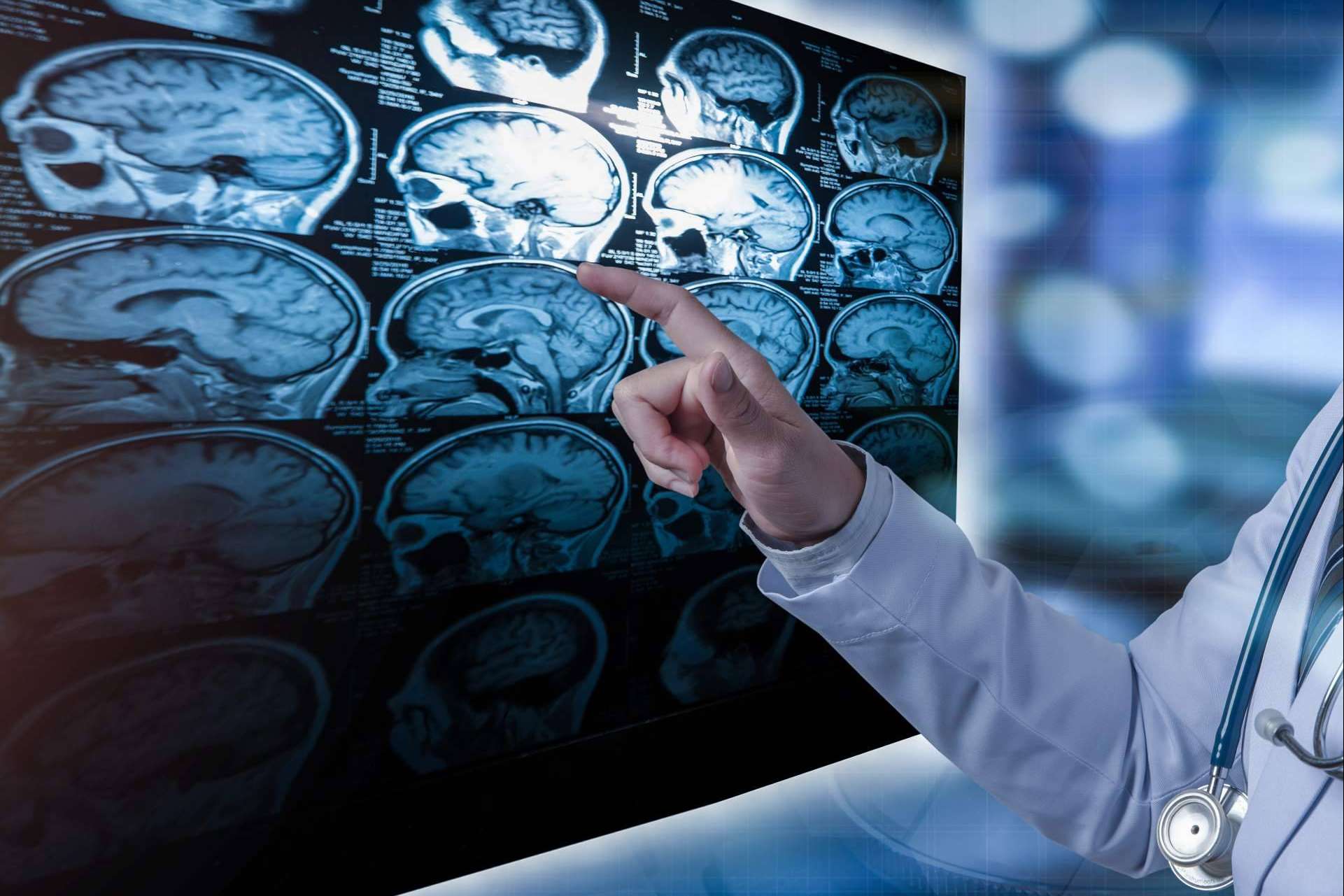 ¿Qué es la esclerosis múltiple?, por INIMA Rehabilitación
