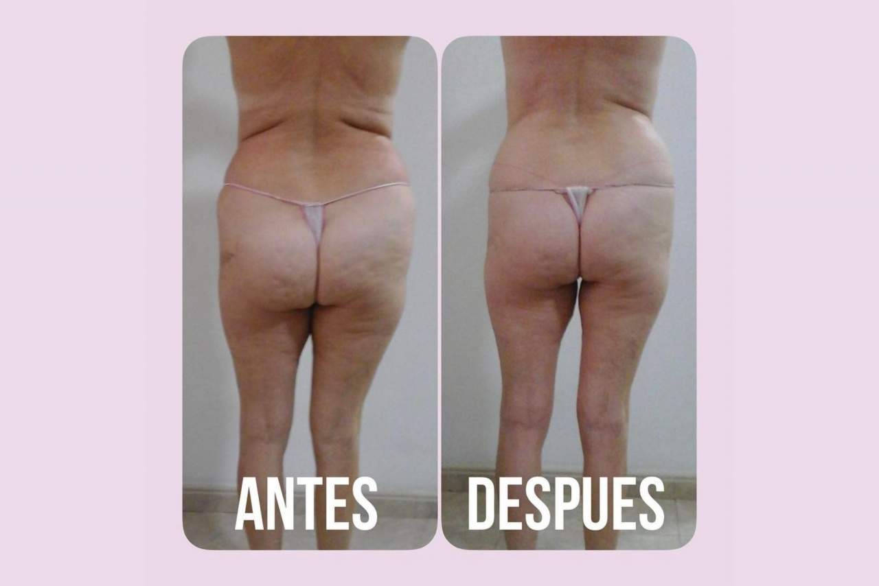 Vanesa Vendrell Estética: el centro tendencia en el corazón de Valencia para tratamientos reductores y anticelulíticos
