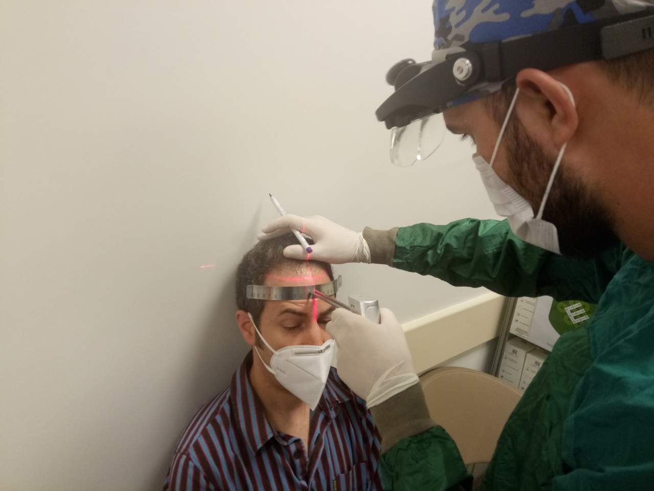 Fue Hair Transplant System: Turismo capilar en Turquía