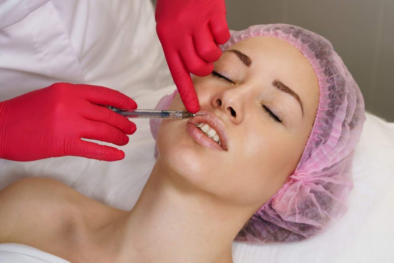 Clínica Fercasy: Hidratación labial con ácido hialurónico