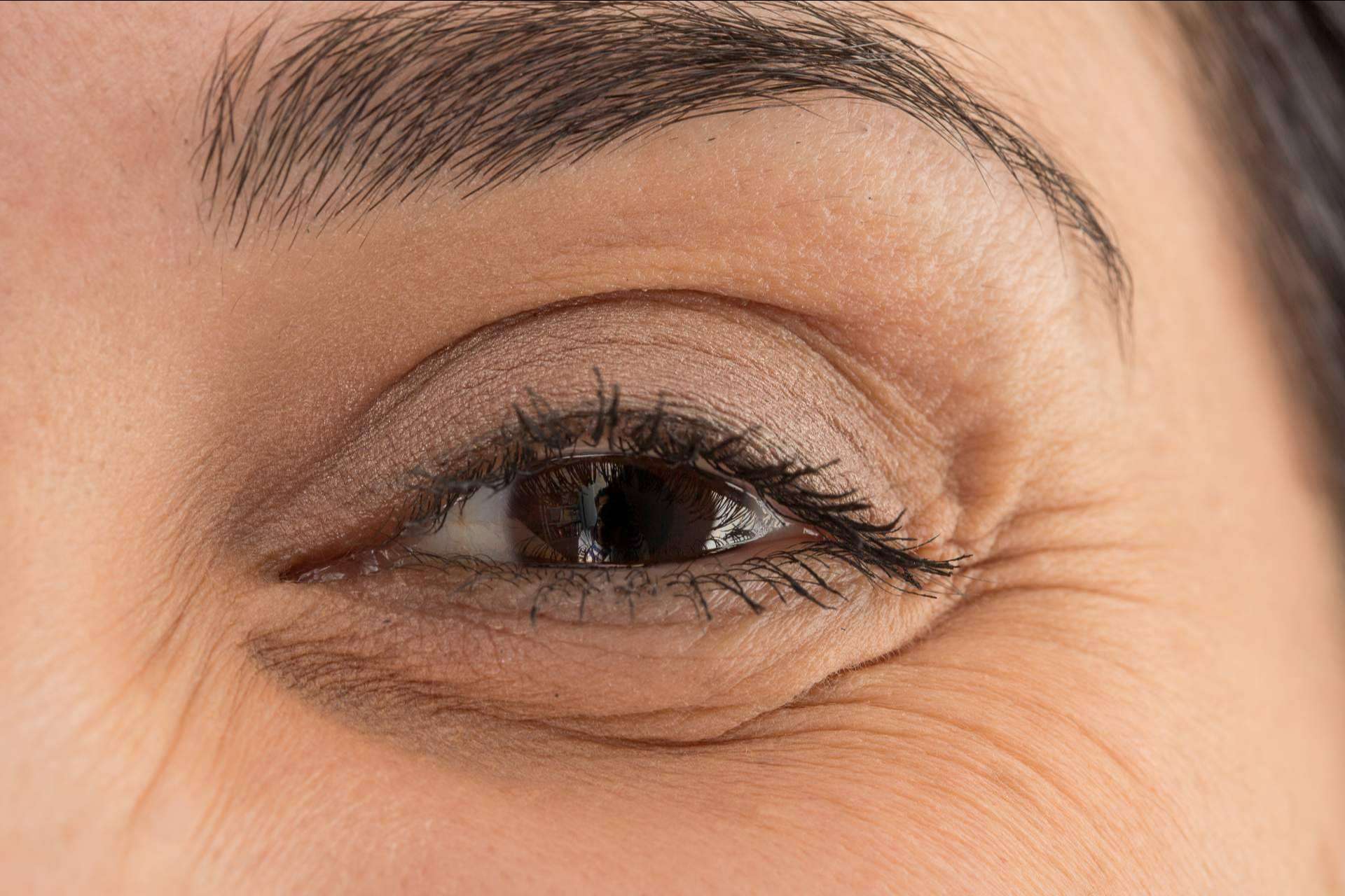 Dr. Carlos Zito es especialista en medicina estética de tratamientos de ojeras